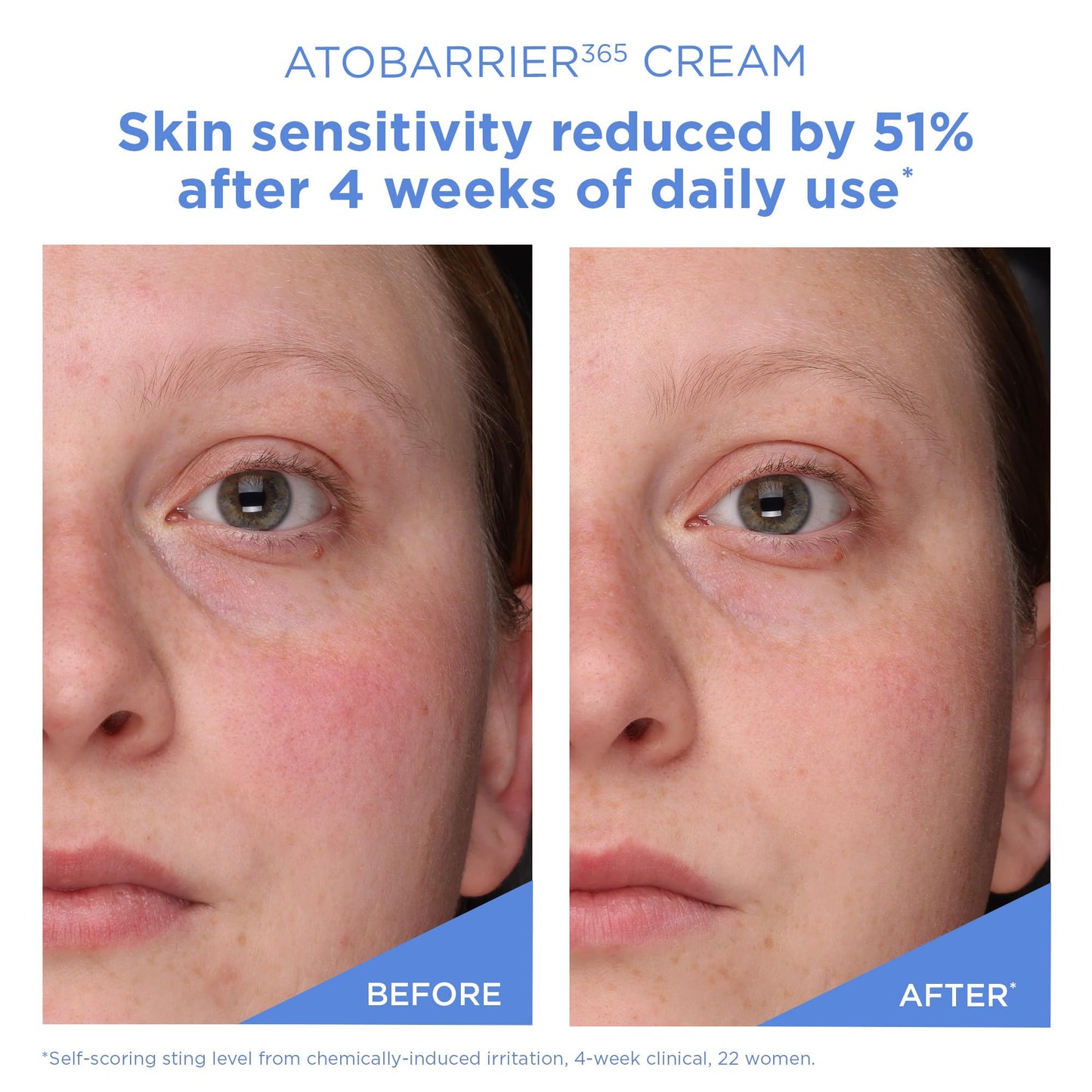 AESTURA ATOBARRIER 365 Cream